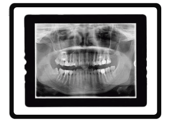 Digital x-rays