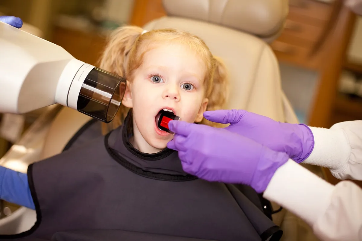 Dental X-Rays For Kids In Frisco, TX - Dental Smart Kids Dentistry