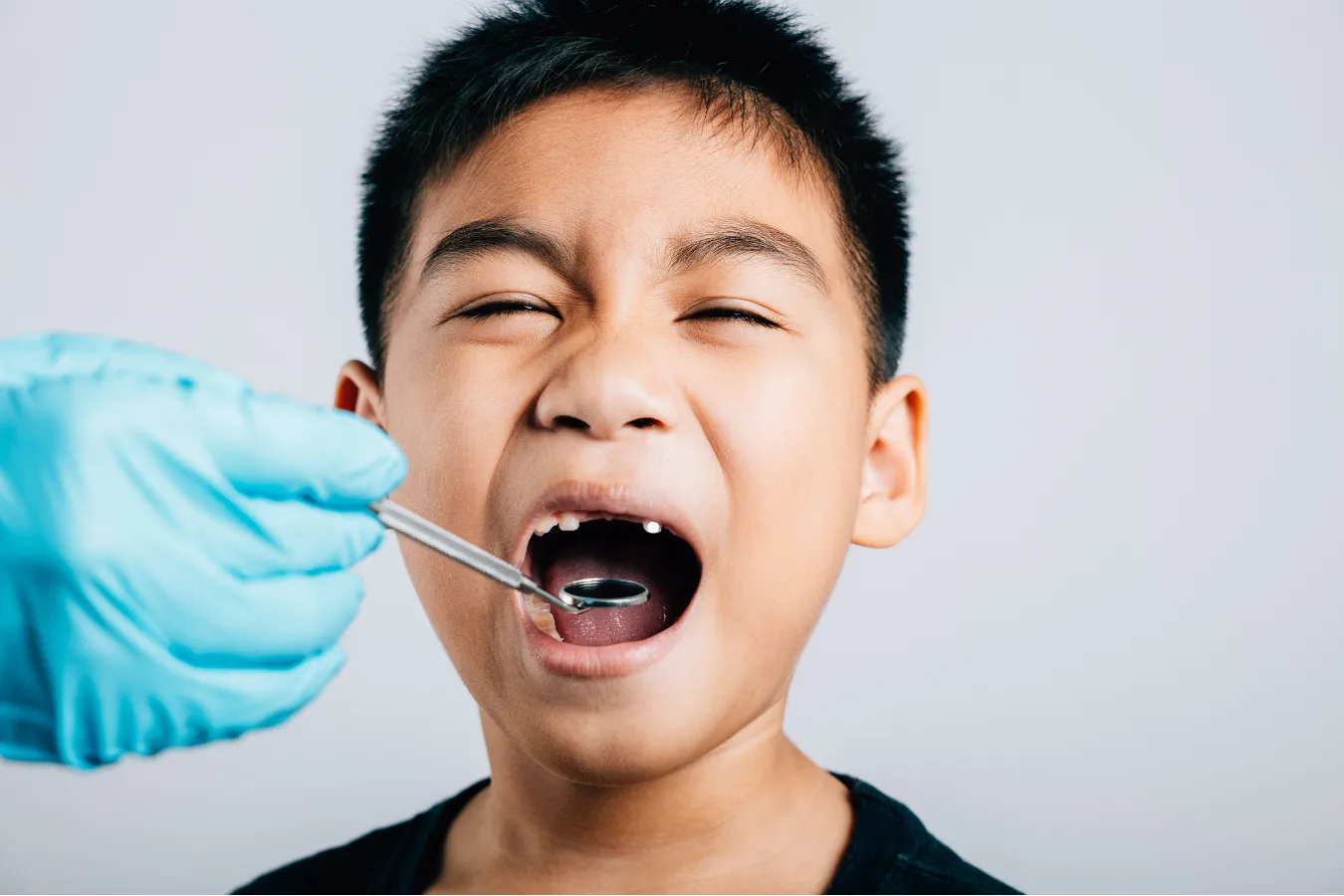 Pediatric Tooth Extractions in Frisco, TX​