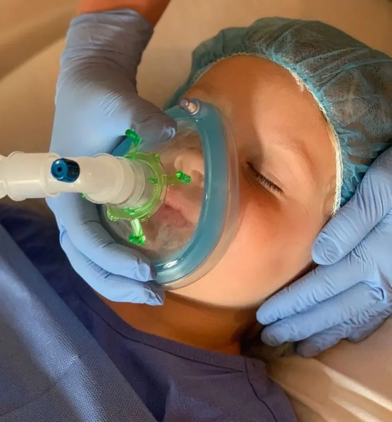 General anesthesia Frisco TX child under safe monitored sedation with oxygen mask at Dental Smart Kids