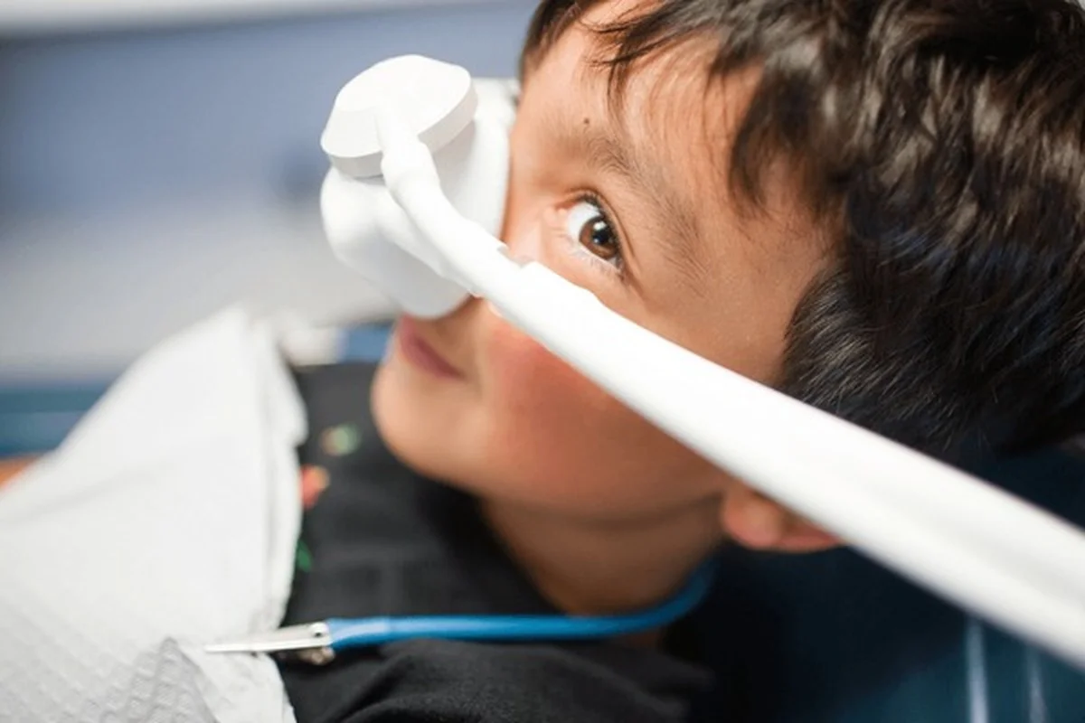 Laughing gas sedation Frisco TX child relaxing with nitrous oxide mask at Dental Smart Kids