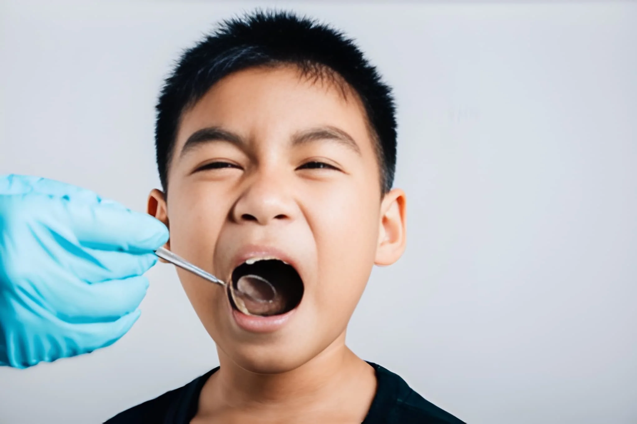 Tooth Extractions Frisco TX – child dental exam at Dental Smart Kids during pediatric tooth extraction checkup