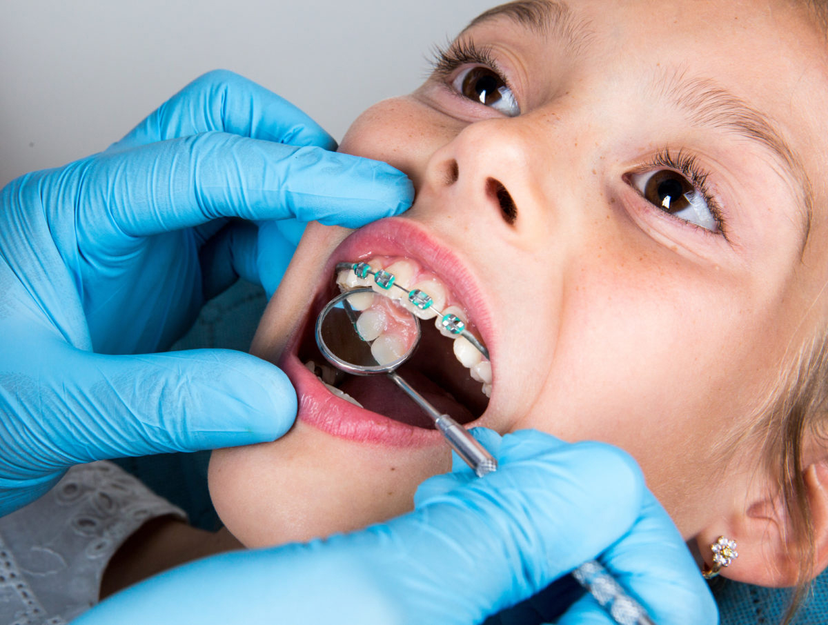 Pediatric orthodontist examining a child’s braces during a visit at Dental Smart Kids in Frisco TX