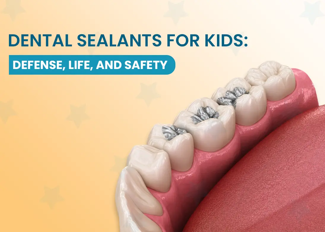Dental Sealants for Kids Defense, Life, and Safety