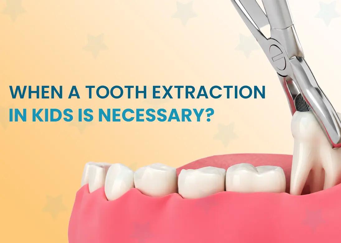 When A Tooth Extraction In Kids Is Necessary